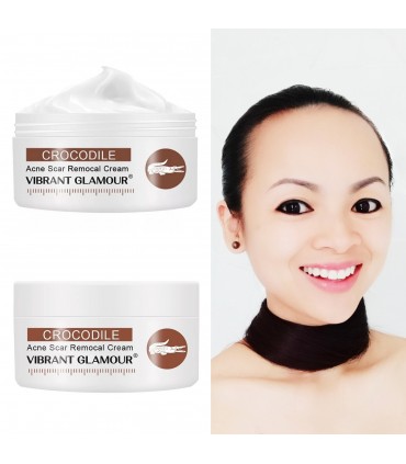 Crème Peptide Crocodile - Crème visage anti-acné anti-rides les cicatrices (30g)