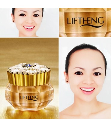 Crème Noble Or au Perle - Crème visage éclaircissante blanchiment anti-acné (10g)