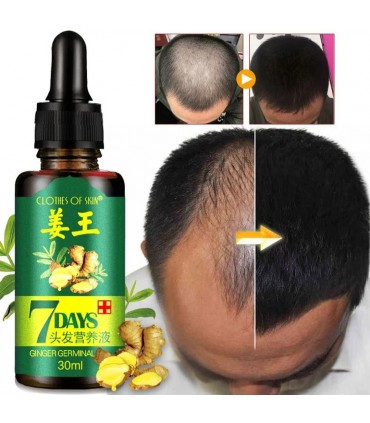 Sérum soins cheveux croissance des cheveux anti-perte de cheveux