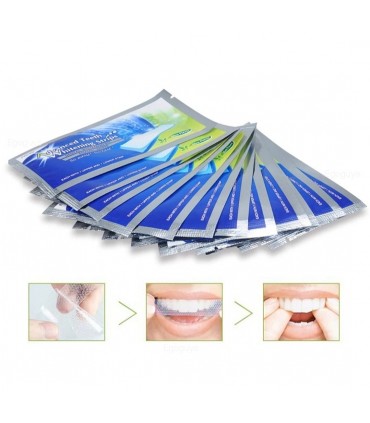 Bande de blanchiment des dents (1 paire)