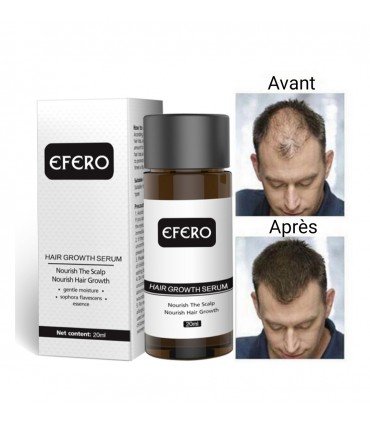 Sérum de croissance cheveux anti-perte des cheveux