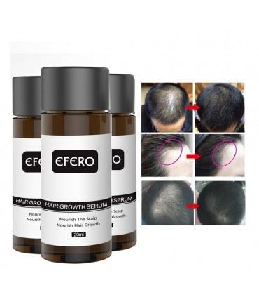 Sérum de croissance cheveux anti-perte des cheveux