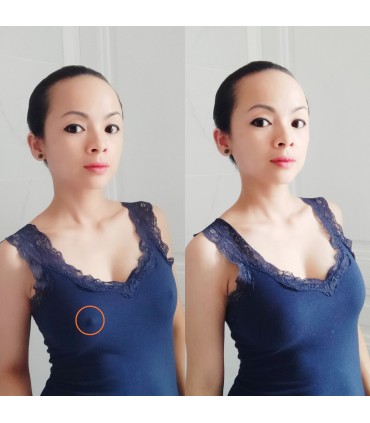 Soutien-gorge adhésifs silicone caché tétons forme fleur 6,5cm