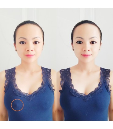 Soutien-gorge adhésifs silicone forme rond 10cm